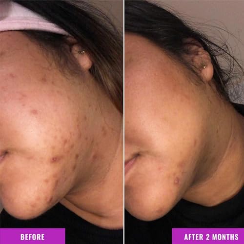 GOOD MOLECULES Discoloration Correcting Serum